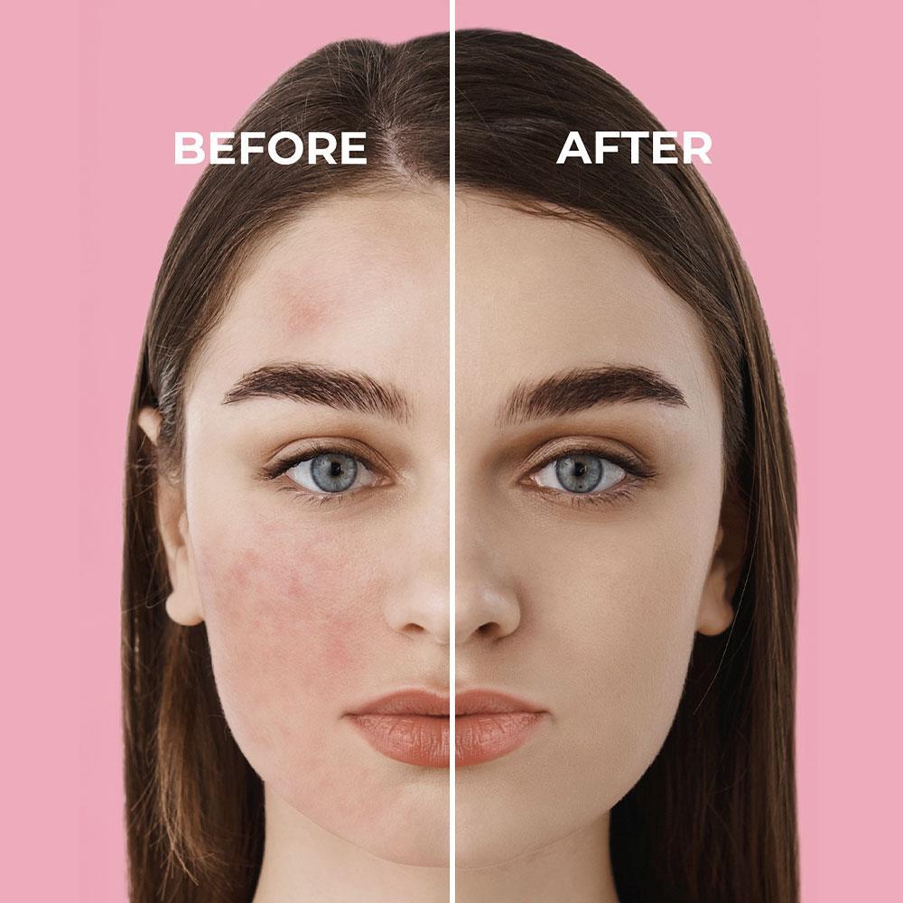 Sinoz Pink Touch Anında Ton Eşitleyici Sıvı Güneş Kremi SPF50+ Mineral Güneş Filtreleri 50 ml 